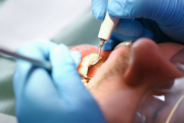 Best Emergency Broken Tooth Repair in Tamalpais Homestead Valley, CA