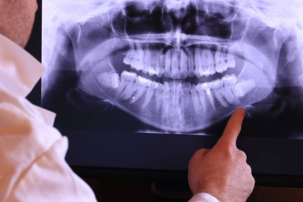 Best Walk-In Emergency Dentist in Tamalpais Homestead Valley, CA