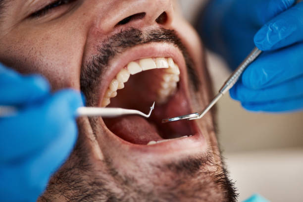 Best Same-Day Emergency Dentist in Tamalpais Homestead Valley, CA